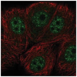 ERCC8 Antibody, Novus Biologicals 100 &mu;L | Buy Online | Novus Biologicals | Fisher Scientific