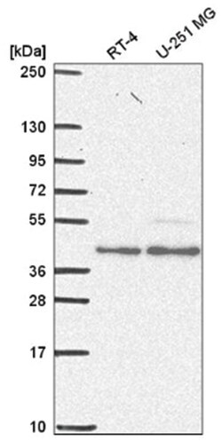ERR alpha/NR3B1 Antibody, Novus Biologicals 25 &mu;L, Unlabeled:Antibodies,