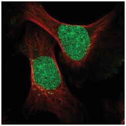 ESCO2 Antibody, Novus Biologicals:Antibodies:Primary Antibodies