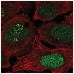 ESCO2 Antibody, Novus Biologicals 25 &mu;L, Unlabeled:Antibodies, Polyclonal