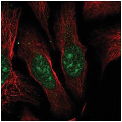 ESF1 Antibody, Novus Biologicals 25 &mu;L, Unlabeled:Antibodies, Polyclonal