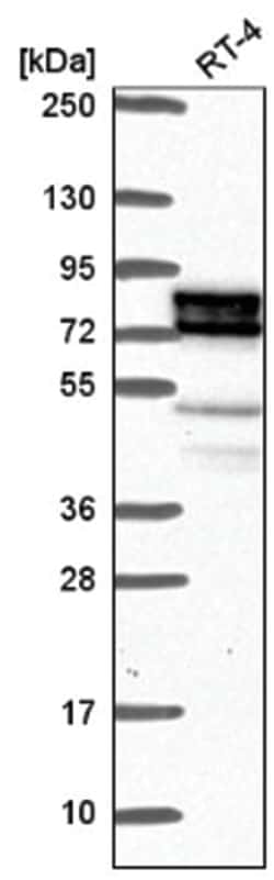 ESRP1 Antibody, Novus Biologicals 100&mu;L; Unlabeled:Antibodies, Polyclonal