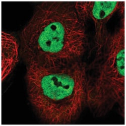 ESRP2 Antibody, Novus Biologicals 100&mu;L; Unlabeled:Antibodies, Polyclonal