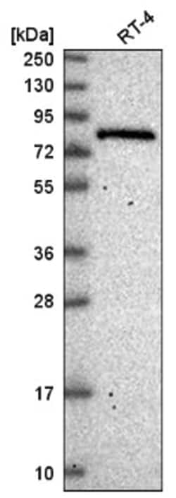 ESRP2 Antibody, Novus Biologicals 25 &mu;L, Unlabeled:Antibodies, Polyclonal