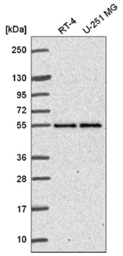 ETEA Antibody, Novus Biologicals:Antibodies:Primary Antibodies