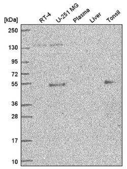 Ets-1 Antibody, Novus Biologicals 100&mu;L; Unlabeled:Antibodies, Polyclonal
