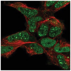 ETS1 associated protein II Antibody, Novus Biologicals 100&mu;L; Unlabeled:Antibodies,