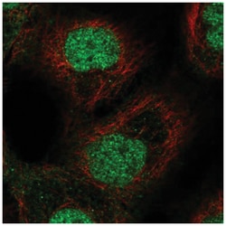 ETS2 Antibody, Novus Biologicals 25 &mu;L | Buy Online | Novus Biologicals | Fisher Scientific