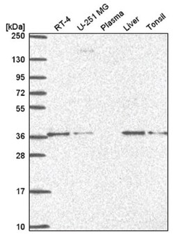 ETV1 Antibody, Novus Biologicals 25 &mu;L, Unlabeled:Antibodies, Polyclonal