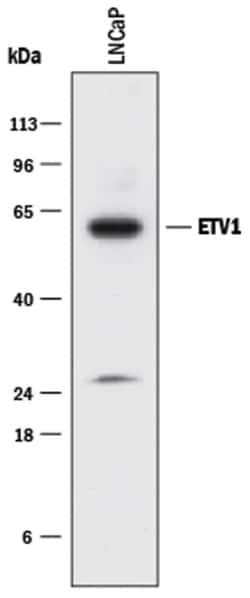 Human ETV1 Antibody, R D Systems 25&mu;g; Unlabeled:Antibodies, Monoclonal