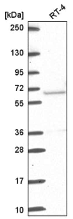 ETV5/ERM Antibody, Novus Biologicals 100&mu;L; Unlabeled:Antibodies, Polyclonal