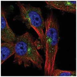EVI5 Antibody, Novus Biologicals 100 &mu;L | Buy Online | Novus Biologicals | Fisher Scientific