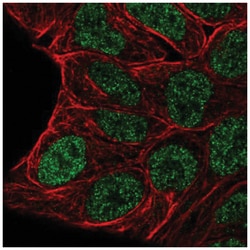 Evx1 Antibody, Novus Biologicals 25 &mu;L:Antibodies, Polyclonal