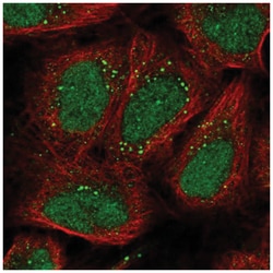EXOC6 Antibody, Novus Biologicals 100&mu;L; Unlabeled:Antibodies, Polyclonal