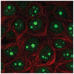 Exosome component 5 Antibody, Novus Biologicals 25 &mu;L, Unlabeled:Antibodies,