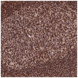 Exosome Component 9 Antibody, Novus Biologicals 100&mu;L; Unlabeled:Antibodies,