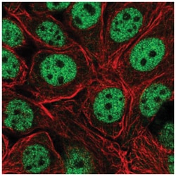 Exportin-T Antibody, Novus Biologicals:Antibodies:Primary Antibodies