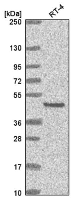 EYA2 Antibody, Novus Biologicals 100&mu;L; Unlabeled:Antibodies, Polyclonal