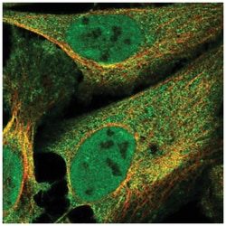 F box protein 38 Antibody, Novus Biologicals 100&mu;L; Unlabeled:Antibodies,
