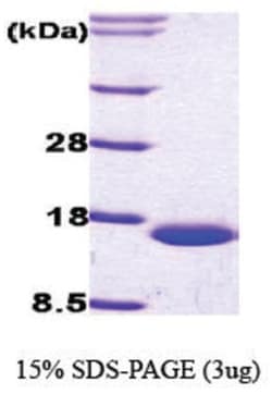 Novus Biologicals&trade;&nbsp;Recombinant Human FABP1/L-FABP Protein