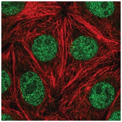 FACA/FANCA Antibody, Novus Biologicals:Antibodies:Primary Antibodies