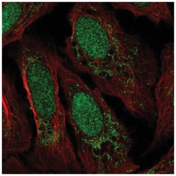 FAKD3 Antibody, Novus Biologicals 25 &mu;L, Unlabeled:Antibodies, Polyclonal