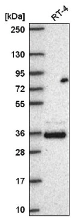 FAM110A Antibody, Novus Biologicals 25 &mu;L, Unlabeled:Antibodies, Polyclonal