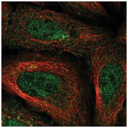 FAM114A1 Antibody, Novus Biologicals 25 &mu;L, Unlabeled:Antibodies, Polyclonal