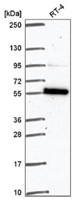 FAM114A1 Rabbit anti-Human, Polyclonal, Novus Biologicals 100&mu;L; Unlabeled:Antibodies,