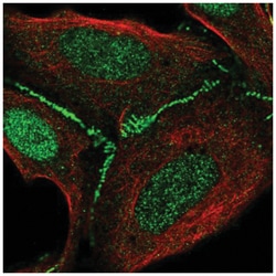 FAM126B Antibody, Novus Biologicals 100&mu;L; Unlabeled:Antibodies, Polyclonal