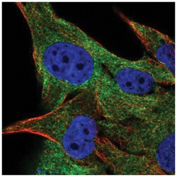 FAM134A Antibody, Novus Biologicals 25 &mu;L:Antibodies, Polyclonal