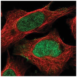 FAM13B1 Antibody, Novus Biologicals 25 &mu;L; Unlabeled:Antibodies, Polyclonal