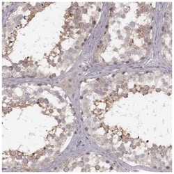 FAM13B1 Antibody, Novus Biologicals 25 &mu;L, Unlabeled:Antibodies, Polyclonal