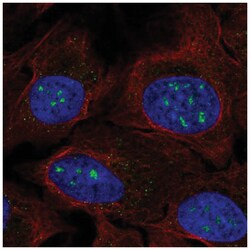 FAM173B Antibody, Novus Biologicals 100 &mu;L | Buy Online | Novus Biologicals | Fisher Scientific