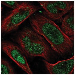 FAM193B Antibody, Novus Biologicals:Antibodies:Primary Antibodies