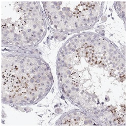 FAM205A Antibody, Novus Biologicals:Antibodies:Primary Antibodies