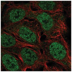 FAM49A Antibody, Novus Biologicals 100&mu;L; Unlabeled:Antibodies, Polyclonal