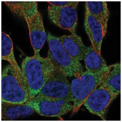 FAM59B Antibody, Novus Biologicals:Antibodies:Primary Antibodies