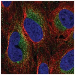FAM62A Antibody, Novus Biologicals 100&mu;L; Unlabeled:Antibodies, Polyclonal
