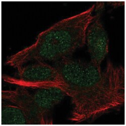 MINDY2 Antibody, Novus Biologicals 100&mu;L; Unlabeled:Antibodies, Polyclonal