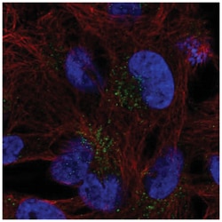 FAM78B Antibody, Novus Biologicals 100&mu;L; Unlabeled:Antibodies, Polyclonal