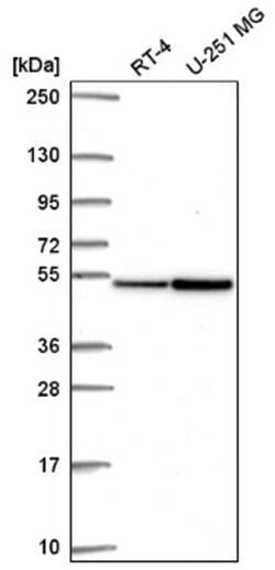 FAM81A Antibody, Novus Biologicals 100&mu;L; Unlabeled:Antibodies, Polyclonal