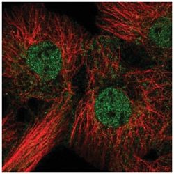 FAM84B Antibody, Novus Biologicals 100&mu;L; Unlabeled:Antibodies, Polyclonal
