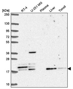 FAM96A Antibody, Novus Biologicals 100&mu;L; Unlabeled:Antibodies, Polyclonal