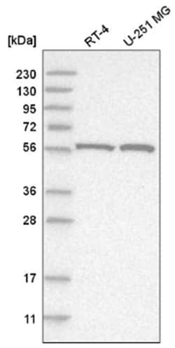 FANCC Antibody, Novus Biologicals 100 &mu;L | Buy Online | Novus Biologicals | Fisher Scientific