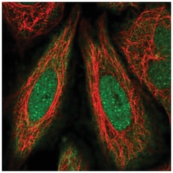 FANCD2 Antibody, Novus Biologicals:Antibodies:Primary Antibodies
