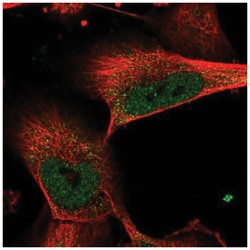 FANCI Antibody, Novus Biologicals 25 &mu;L; Unconjugated:Antibodies, Polyclonal
