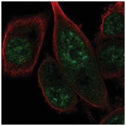 FANCM Antibody, Novus Biologicals 25 &mu;L:Antibodies, Polyclonal