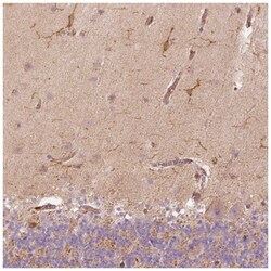 Fascin Antibody, Novus Biologicals:Antibodies:Primary Antibodies