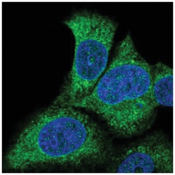FATP3/SLC27A3 Antibody, Novus Biologicals 25 &mu;L, Unlabeled:Antibodies,